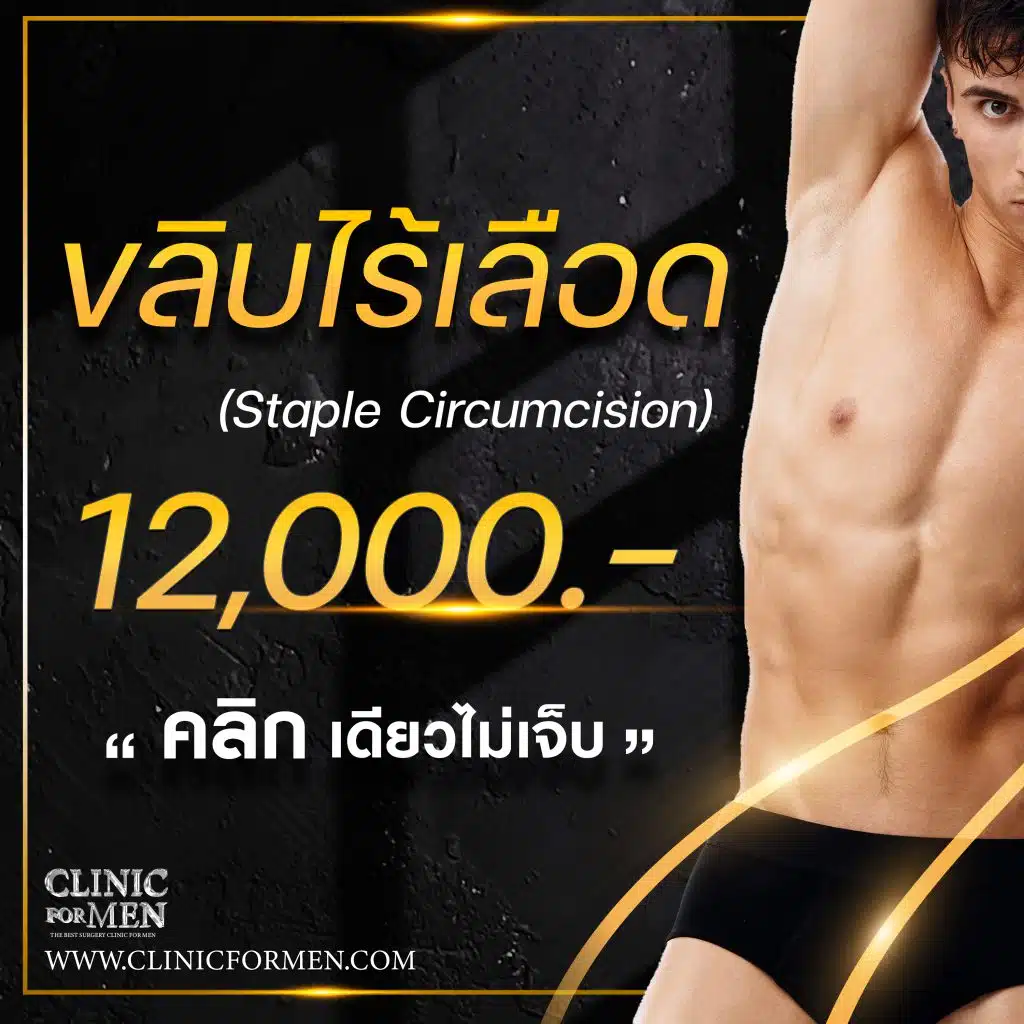 ขลิบไร้เลือด ทางเลือกที่ทันสมัย (Staple Circumcision)