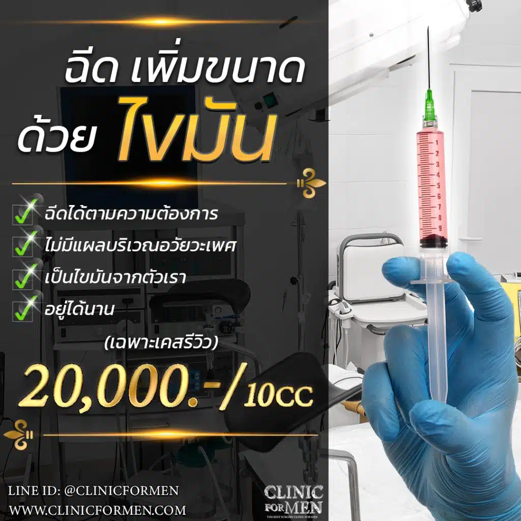 เพิ่มขนาดอวัยวะเพศชายโดยการฉีดไขมัน (Fat Tranfer)