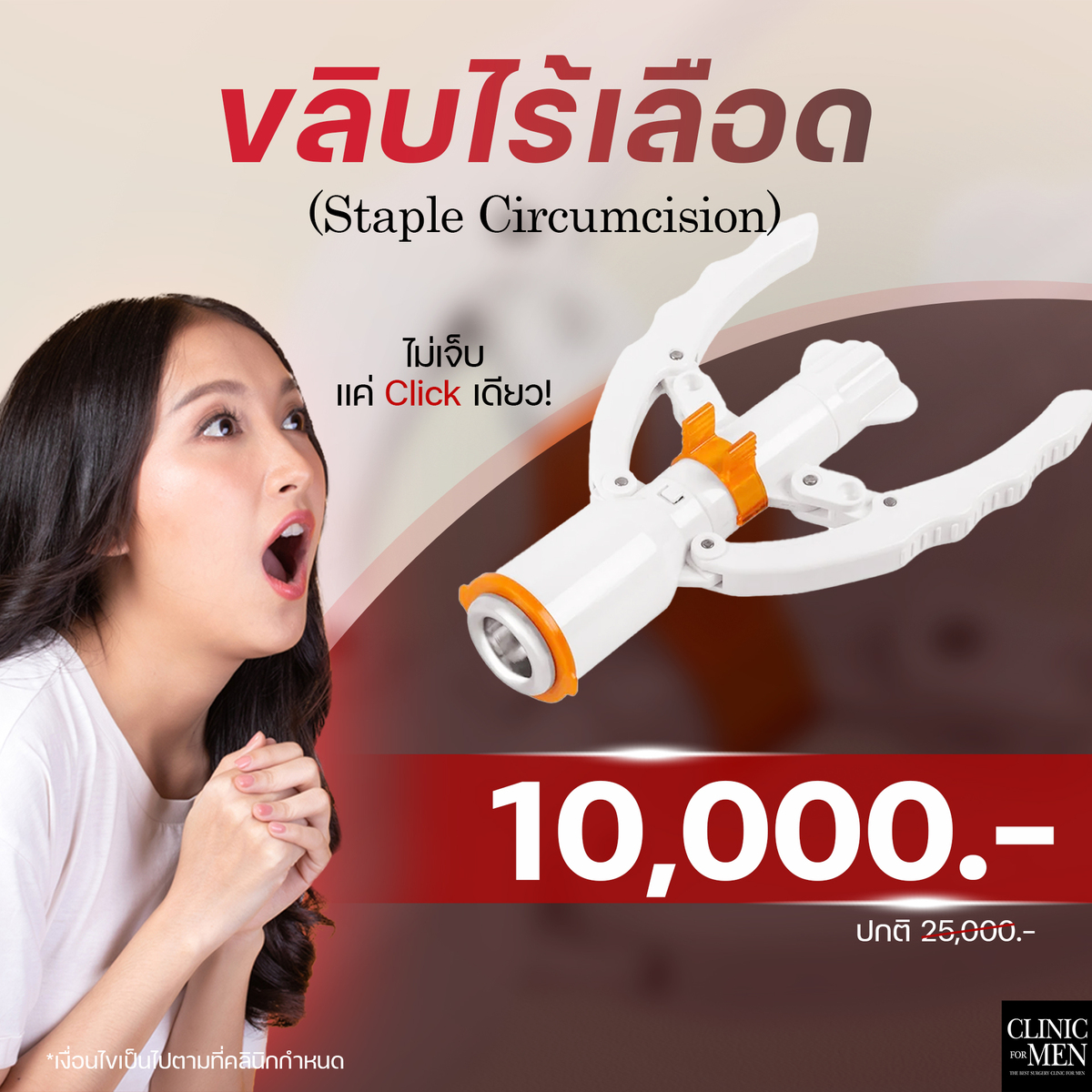 โปรโมชั่น ขลิบไร้เลือด ทางเลือกที่ทันสมัย (Staple Circumcision)