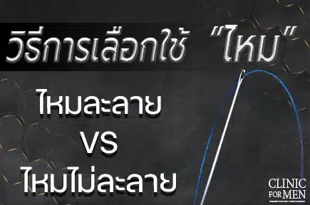 วิธีการเลือกใช้ไหมเย็บแผล