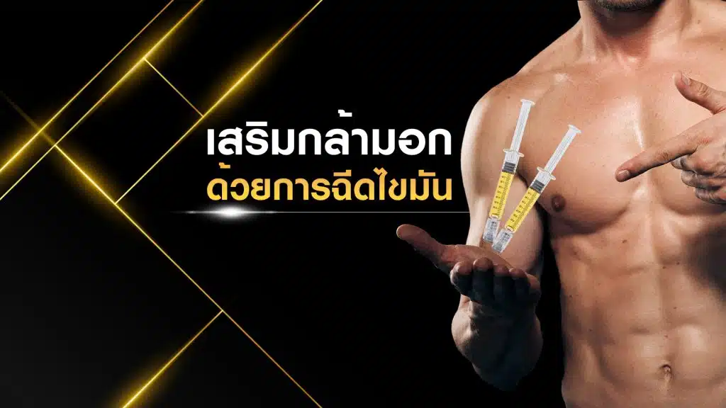ฉีดไขมันเสริมกล้ามอก