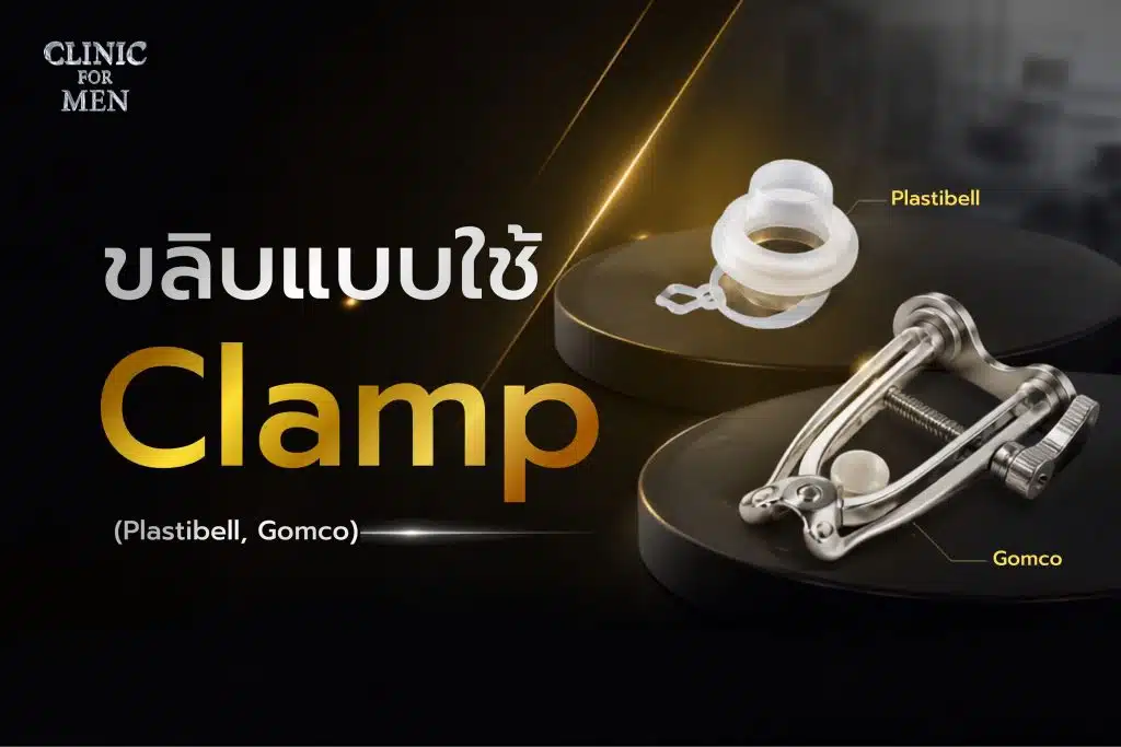 ขลิบแบบใช้ Clamp คืออะไร?