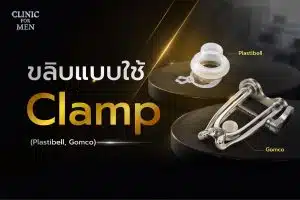 ขลิบแบบใช้ Clamp คืออะไร?