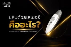 การขลิบด้วยเลเซอร์